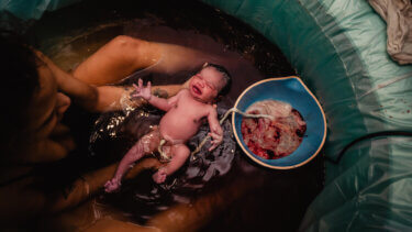 11 Surprising Things That Happen After Giving Birth