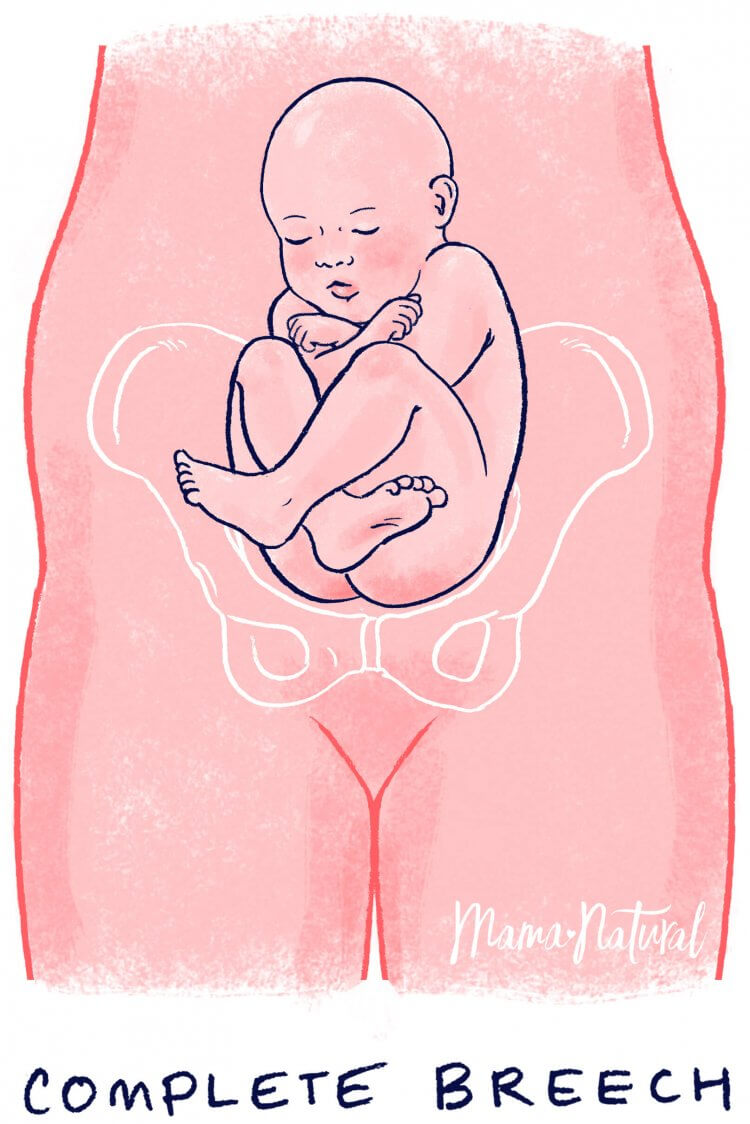 Normal Baby Position In Womb