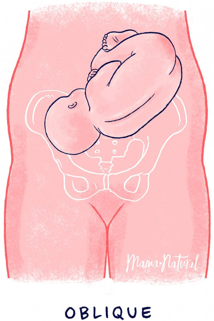 Is Your Baby In This Ideal Fetal Position Images