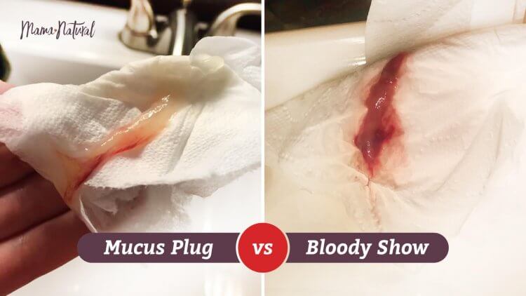 Bloody Show: Here's What You Need to. difference between discharge and...