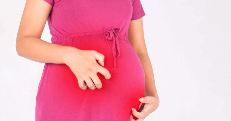 Cholestasis of Pregnancy Risk Factors and Complications for Mama and Baby - Mama Natural