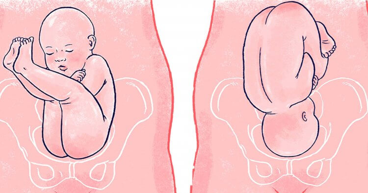 Fetal position is one of the most important considerations when it comes to labor and delivery. But it's something many women don’t consider or even realize they have any control over. Here we explain exactly what fetal position is, why it matters, and how to coax baby into the ideal position for labor.