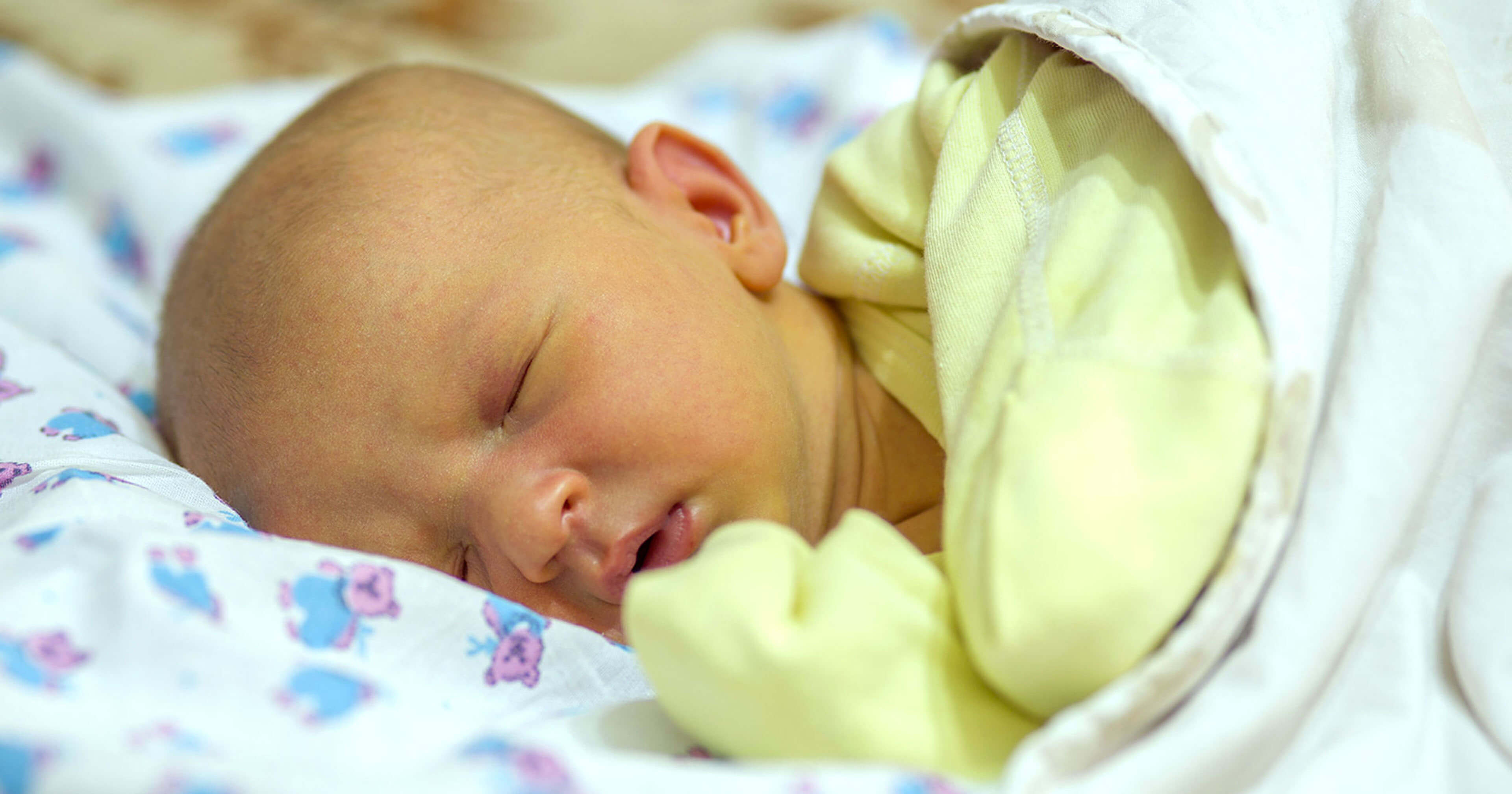 Natural Ways to Treat Jaundice in Newborn Babies