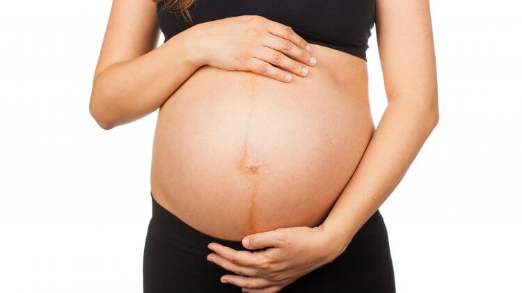 Our bodies do a lot of weird things during pregnancy, linea nigra included. Find out when this dark line usually appears and why, when it disappears, plus get natural remedies to lighten the pigmentation. We've also got the inside scoop on what linea nigra says about your baby's sex.