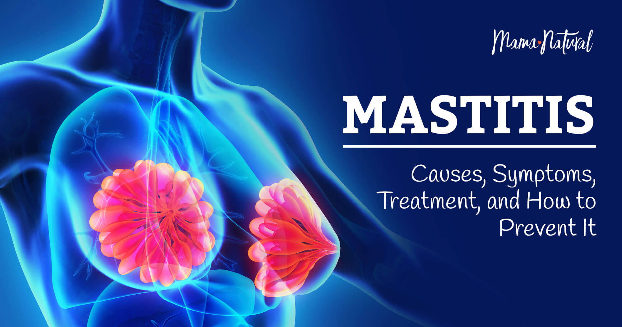 Mastitis: Causes, Signs, and Treatment