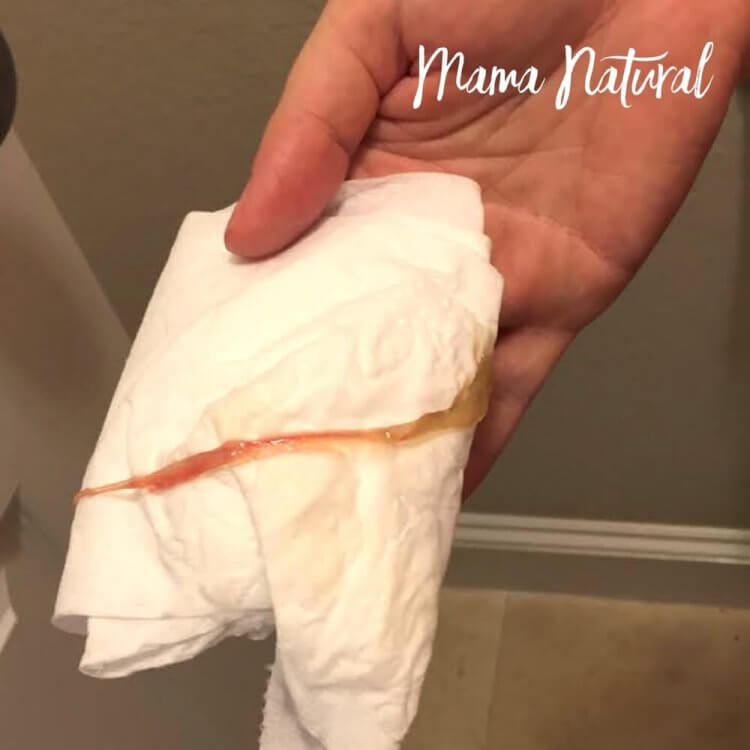 السدادة المخاطية هل يبدأ المخاض عند خروجها بالصور Mama Natural