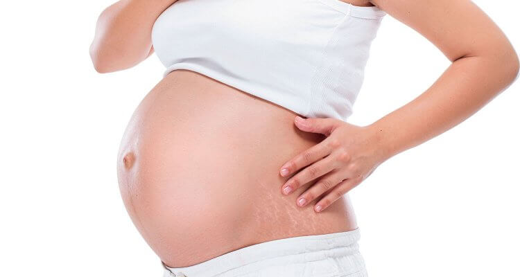 About 90% of women get pregnancy stretch marks and assume it's genetics but there actually IS a way to prevent and even treat stretch marks naturally.