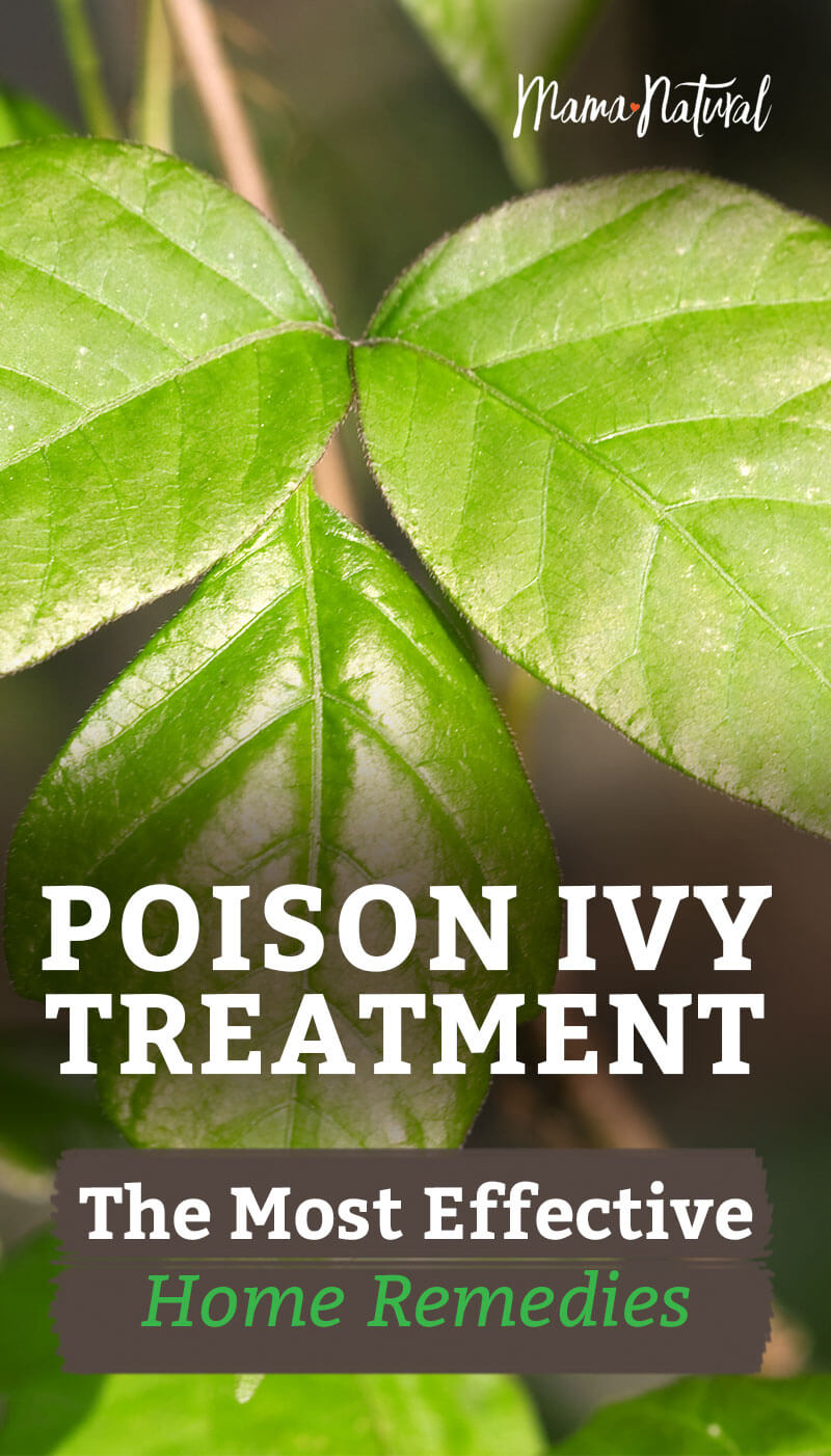 How Is Poison Ivy Treatment
