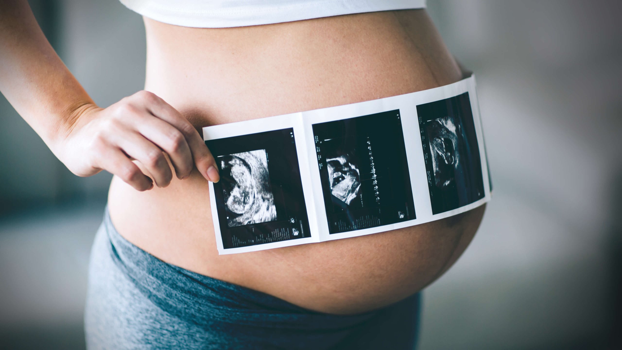 Here's info on the risks vs. rewards of pregnancy ultrasounds - plus a "middle way" to help you reap all the benefits and minimize the dangers.