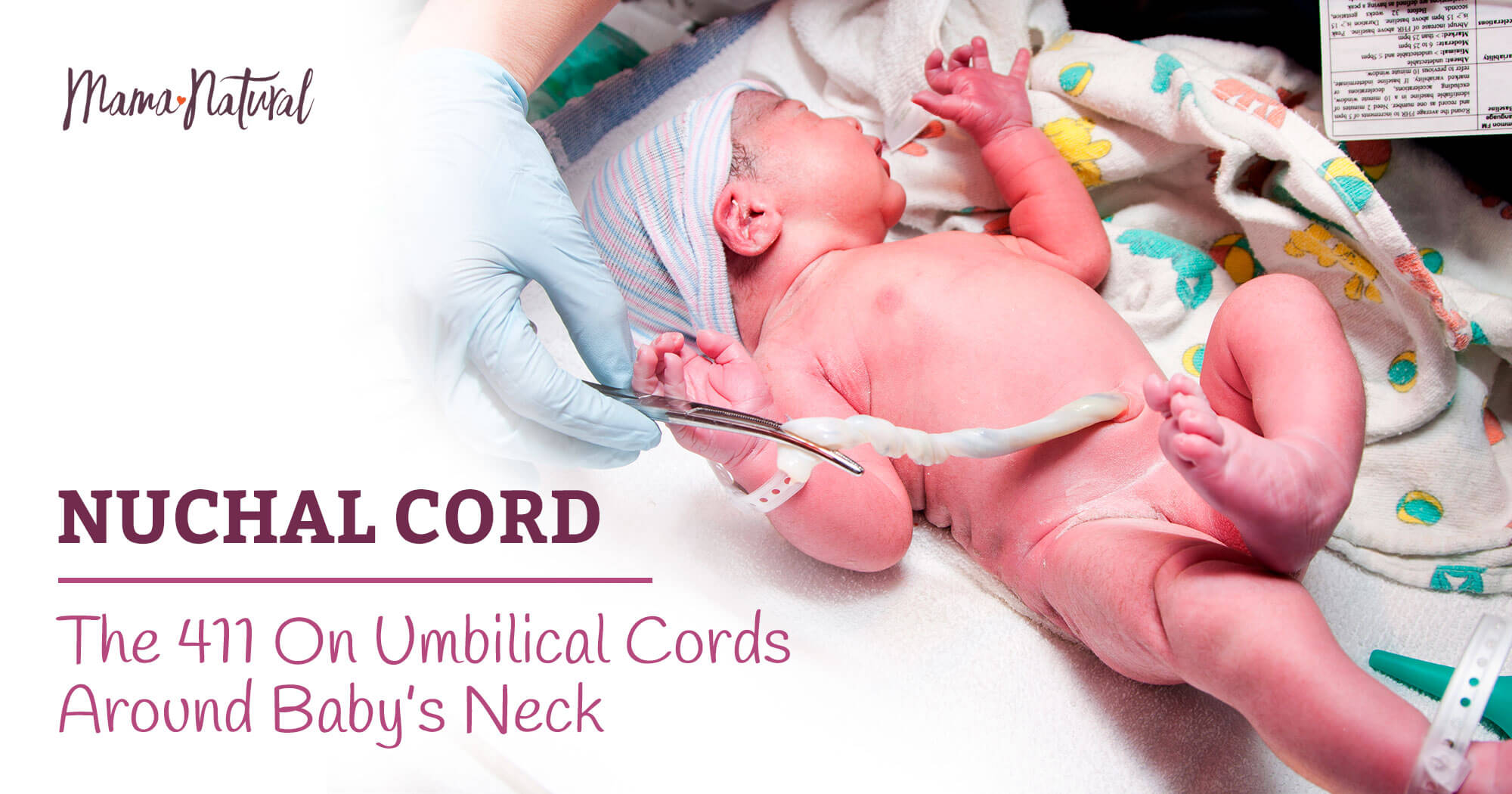 Nuchal Cord: Managing Delivery if the Umbilical Cord Wraps Around the Baby's  Neck, UNM Health Blog