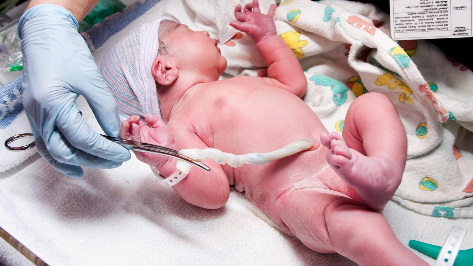 New born baby - girl with remainder of umbilical cord after successful  childbirth. Real birthing and new