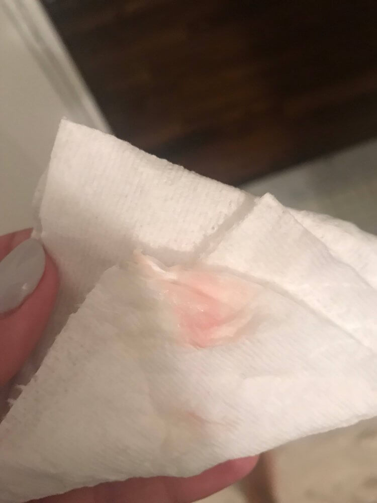 does this look like implantation bleeding? : r/tryingtoconceive