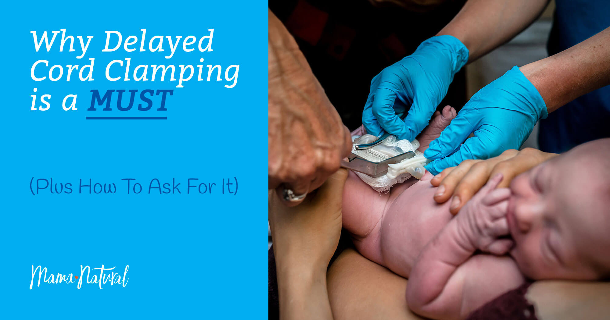 Why Delayed Cord Clamping Is a MUST (Plus How to Ask for It) Why Delayed Cord Clamping Is a MUST (Plus How to Ask for It)