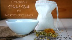 Does your child have a rash or hives? Redness, inflammation, pain, itching? Here's how to relieve the symptoms naturally with an easy herbal bath.