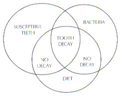 How tooth decay happens