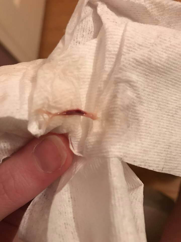 what does implantation bleeding look like on toilet paper